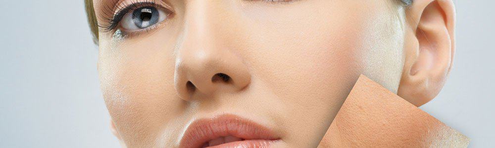 Can You Get Laser Hair Removal On Your Face?