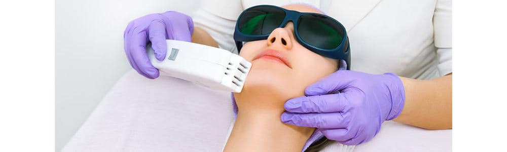 Chin Laser Hair Removal for Women
