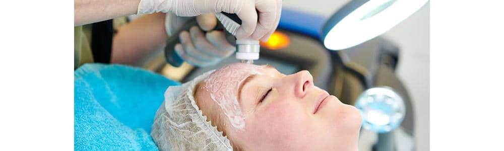 Forehead Laser Hair Removal for Women