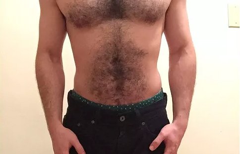 a guy with hairy chest before laser hair removal