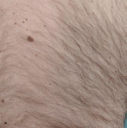 persons hairy arm before laser hair removal