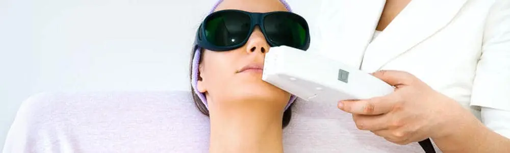 Lip Laser Hair Removal for Women