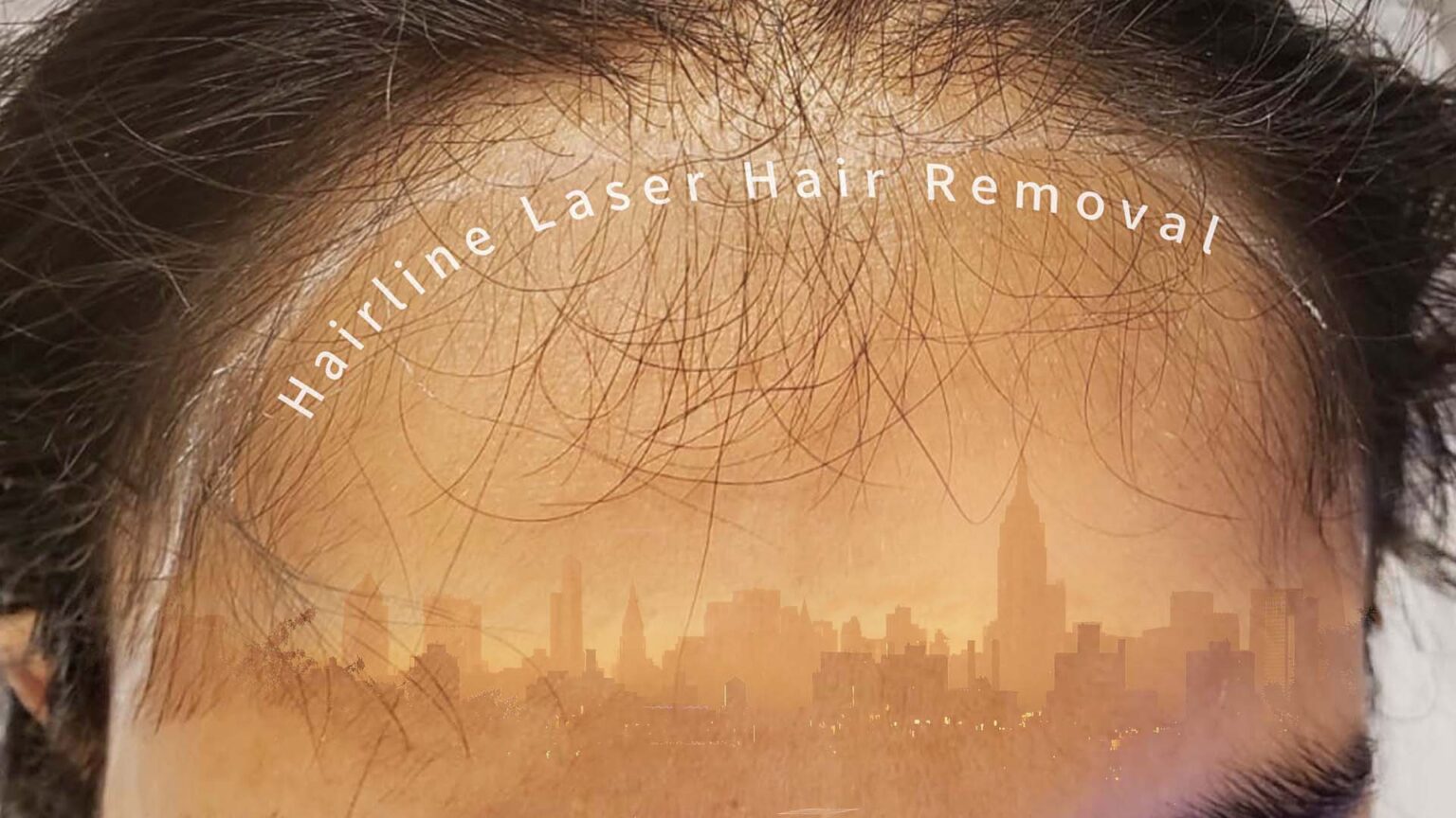 Laser Touch laser spa NYC Forehead Laser Hair Removal for Women artical blog Hair removal and more advanced treatment for you and you body