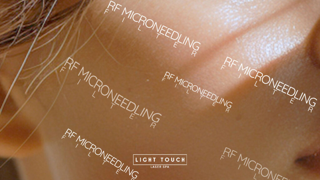 Light Touch Laser Spa NYC best RF Microneedling treatment in manhattan skin tighatning banner