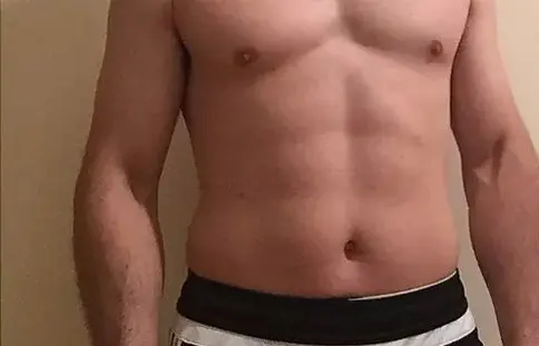 a guy with hairy chest after laser hair removal