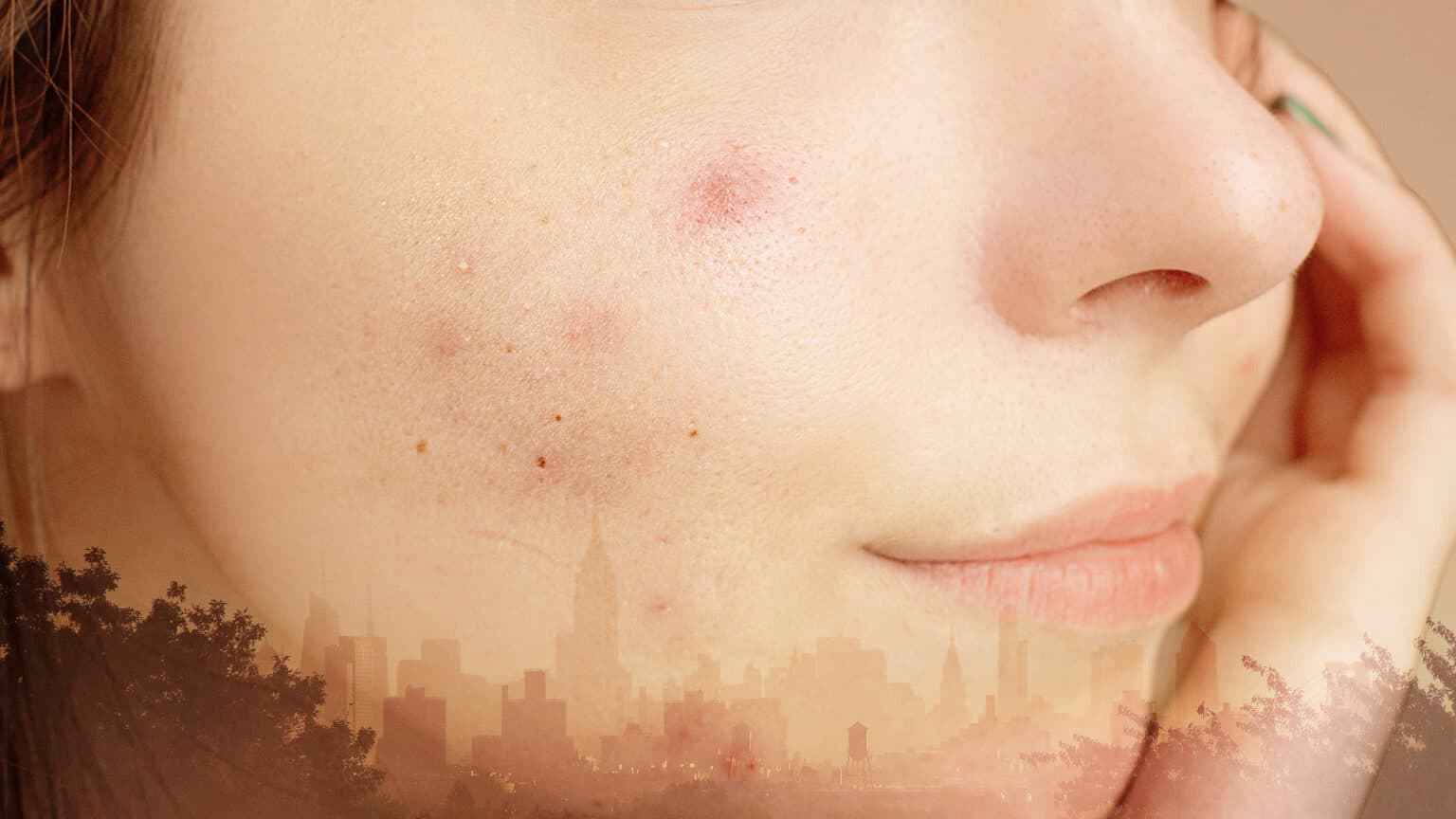 Laser Touch laser spa NYC Acne laser hair removal nyc It can be treated differently 3 Artical advanced laser treatment Forevermore Yourself