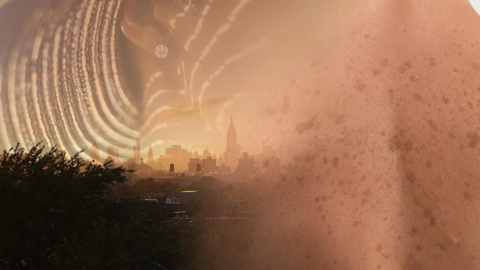 Light Touch Laser Spa NYC Hyperpigmentation Sun Spot Laser Removal advanced laser treatments