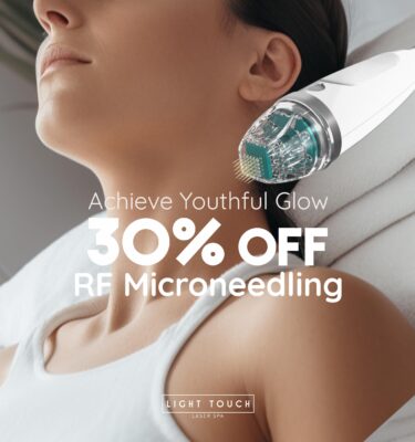 Microneedling for face and neck area in 30% off