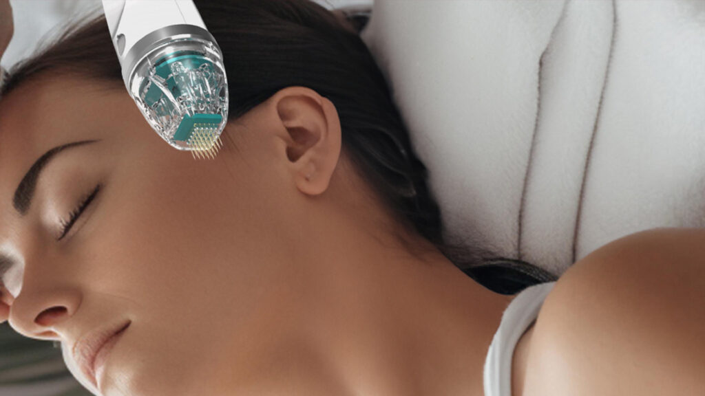 V Light Touch Laser Spa NYC Rf Microneedling Treatment banner 3